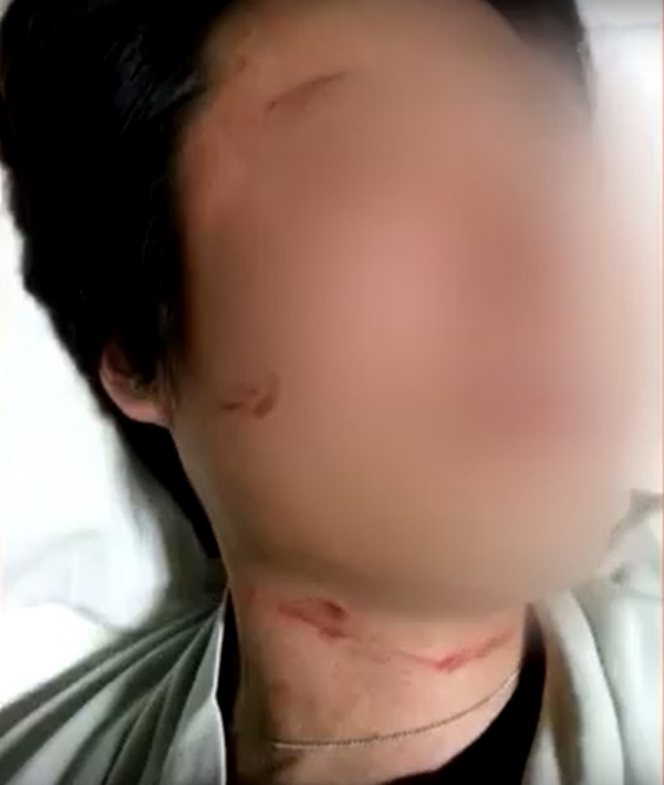 박 씨가 폭행 당한 증거로 제출한 사진 (사진=KBS뉴스)
