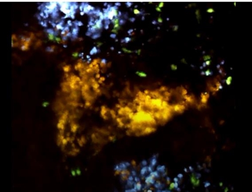 산 생쥐의 암 종양(청색·오렌지색)을 공격하는 T세포(녹색)/실시간 영상 캡처 (파스퇴르 연구소 필리프 보우소 등 제공)