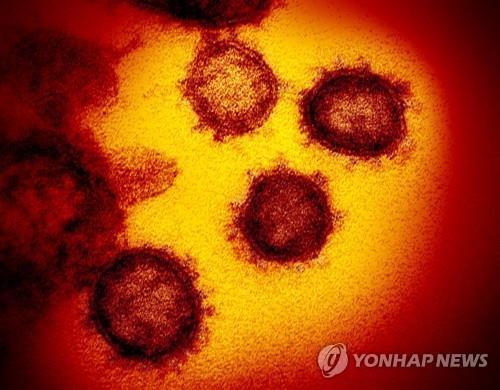 전자 현미경으로 찍은 신종 코로나바이러스[연합뉴스 자료사진]